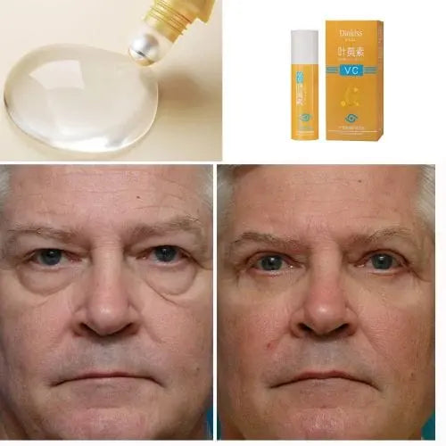 LuteínaSkin™ Sérum Rejuvenecedor – Piel con mejor apariencia